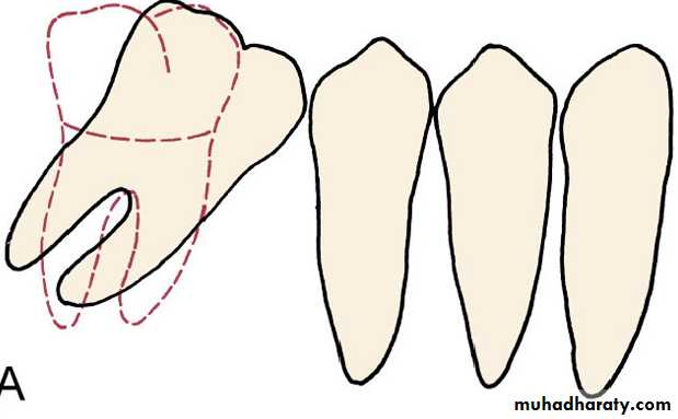 adult orthodontics LEC