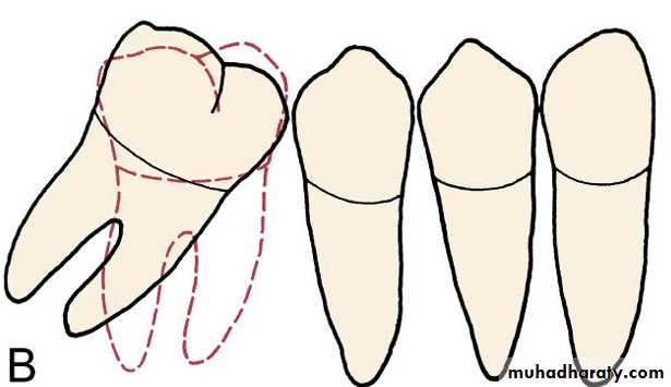 adult orthodontics LEC