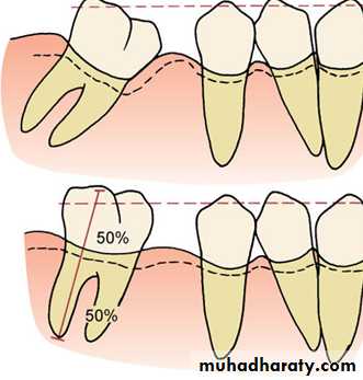 adult orthodontics LEC
