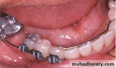 adult orthodontics LEC