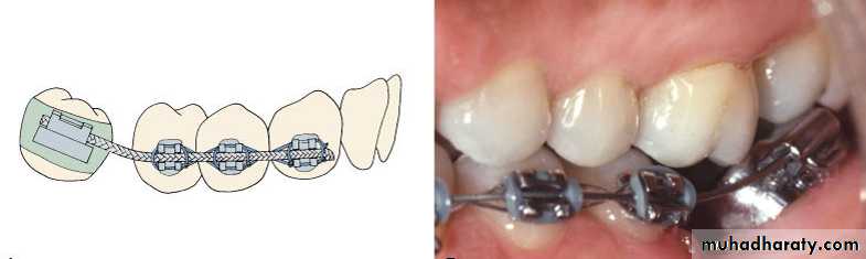 adult orthodontics LEC