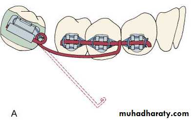 adult orthodontics LEC