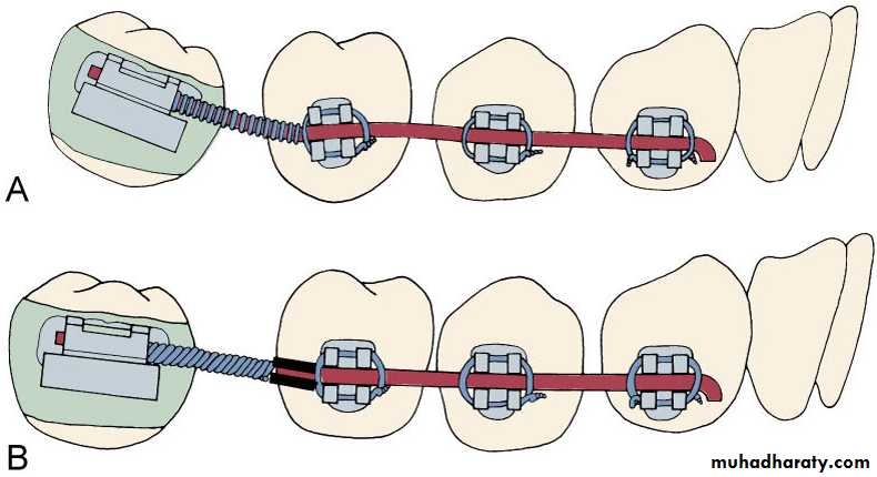 adult orthodontics LEC