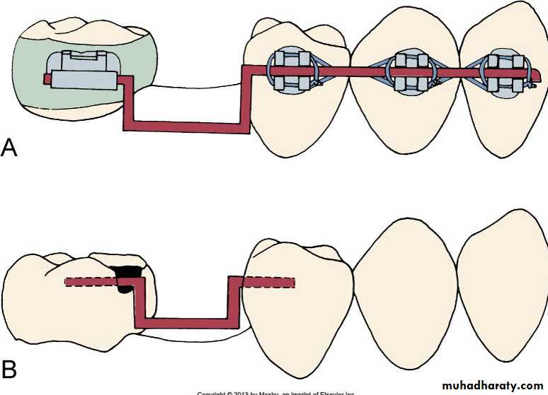adult orthodontics LEC