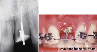 adult orthodontics LEC