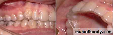 adult orthodontics LEC