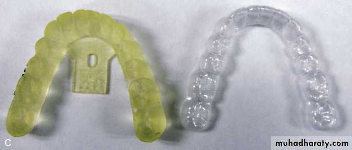 adult orthodontics LEC