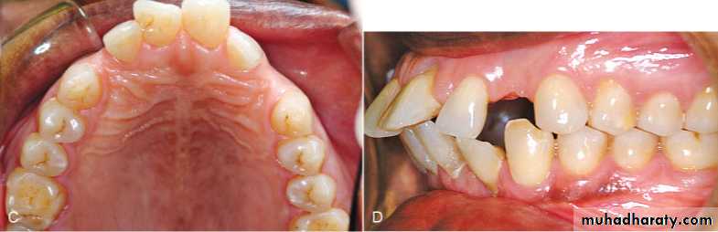adult orthodontics LEC