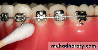 adult orthodontics LEC