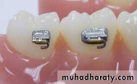adult orthodontics LEC