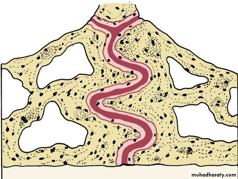 posterior crossbite