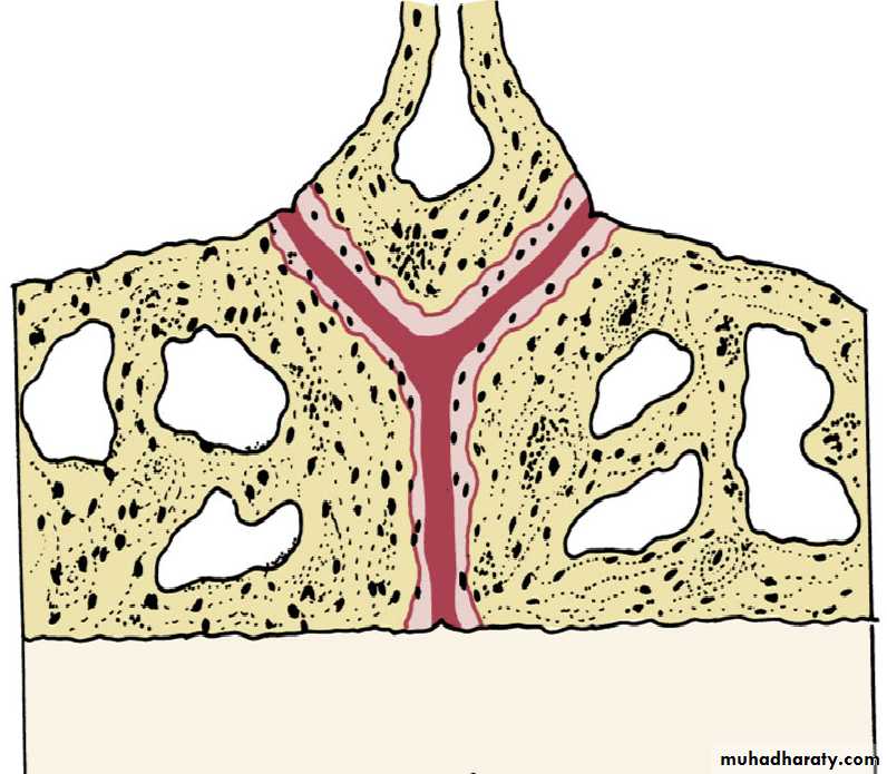 posterior crossbite