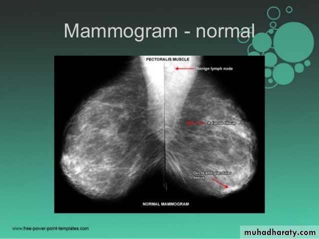 Mammogram