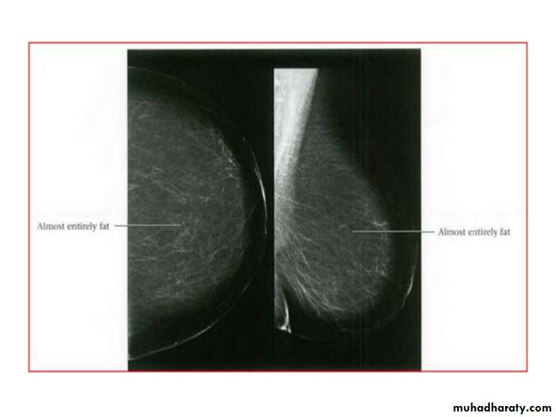 Mammogram