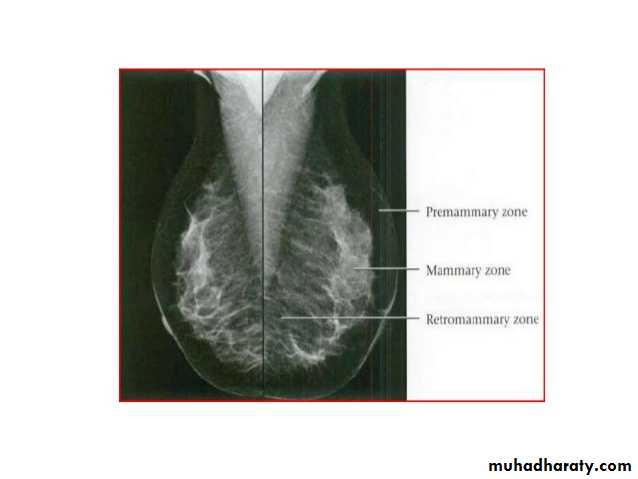 Mammogram