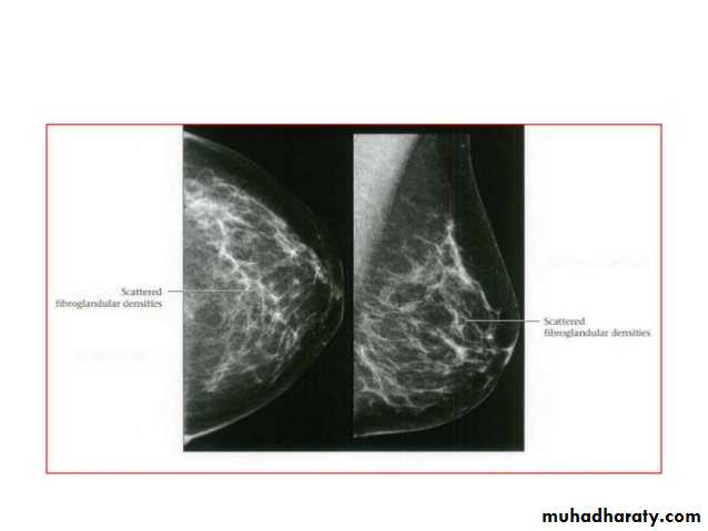Mammogram