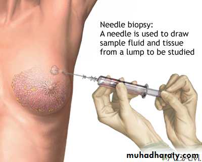 Mammogram