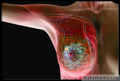 Mammogram