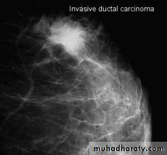 Mammogram
