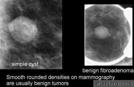 Mammogram