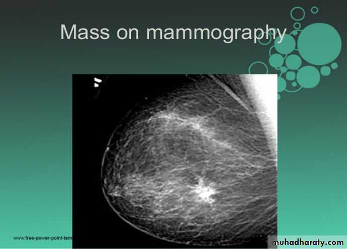 Mammogram