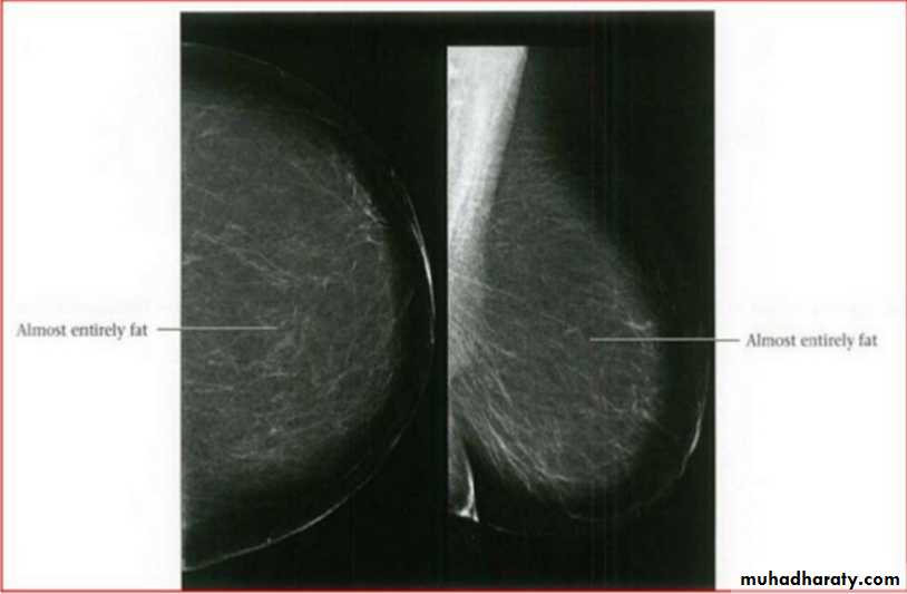 Mammogram