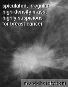 Mammogram