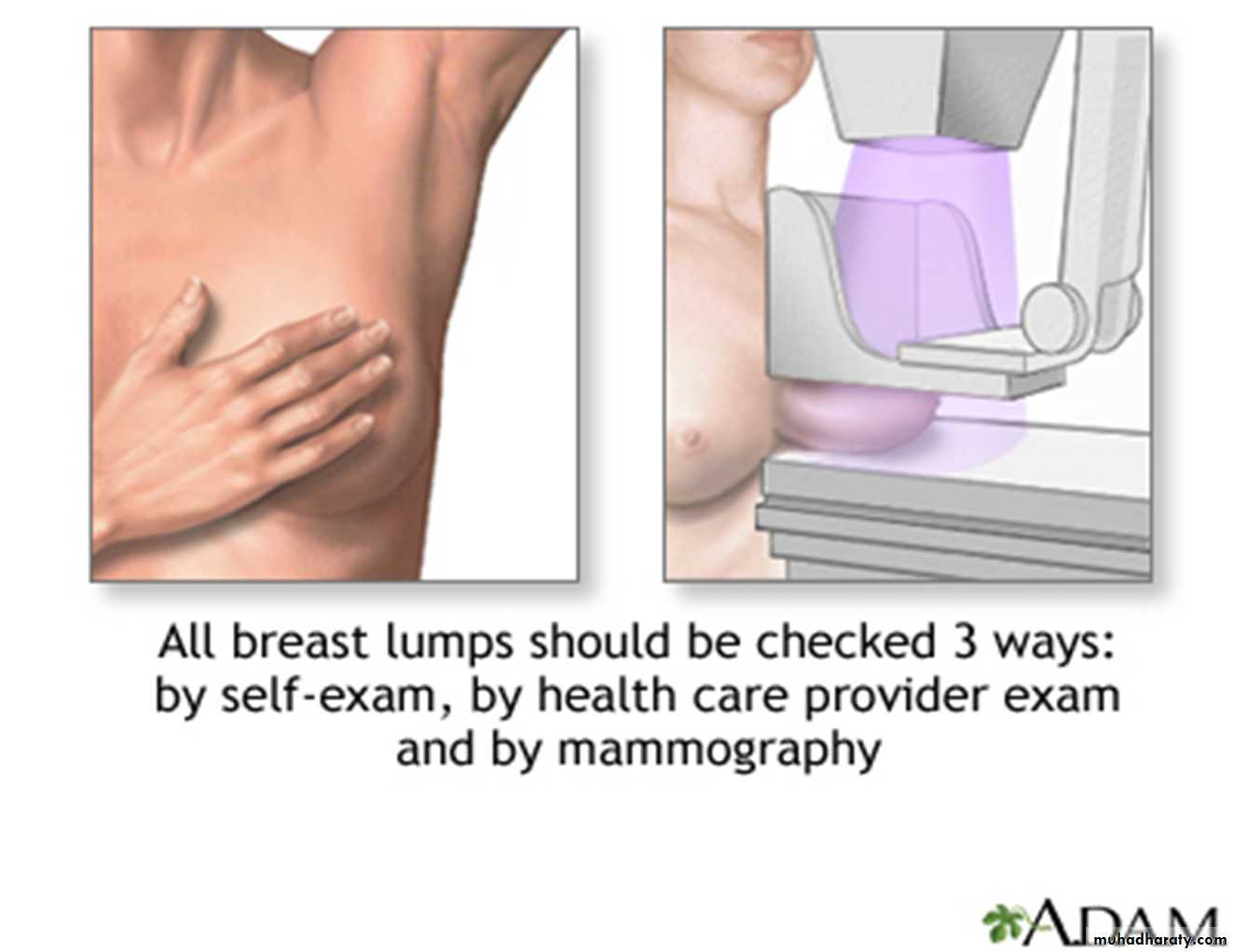Mammogram