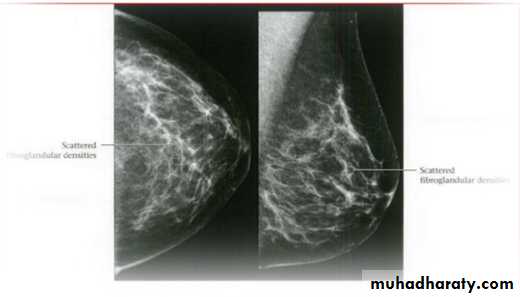 Mammogram