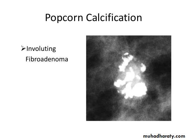 Mammogram