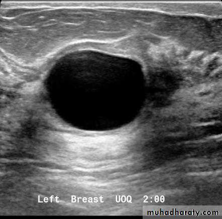 Mammogram