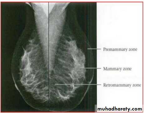 Mammogram
