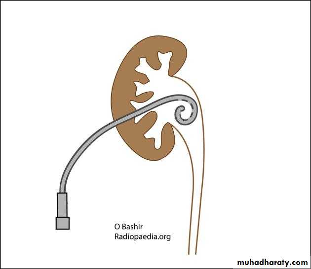Urology