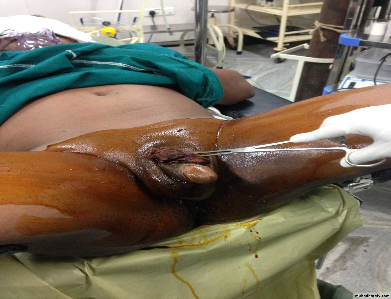 Urology