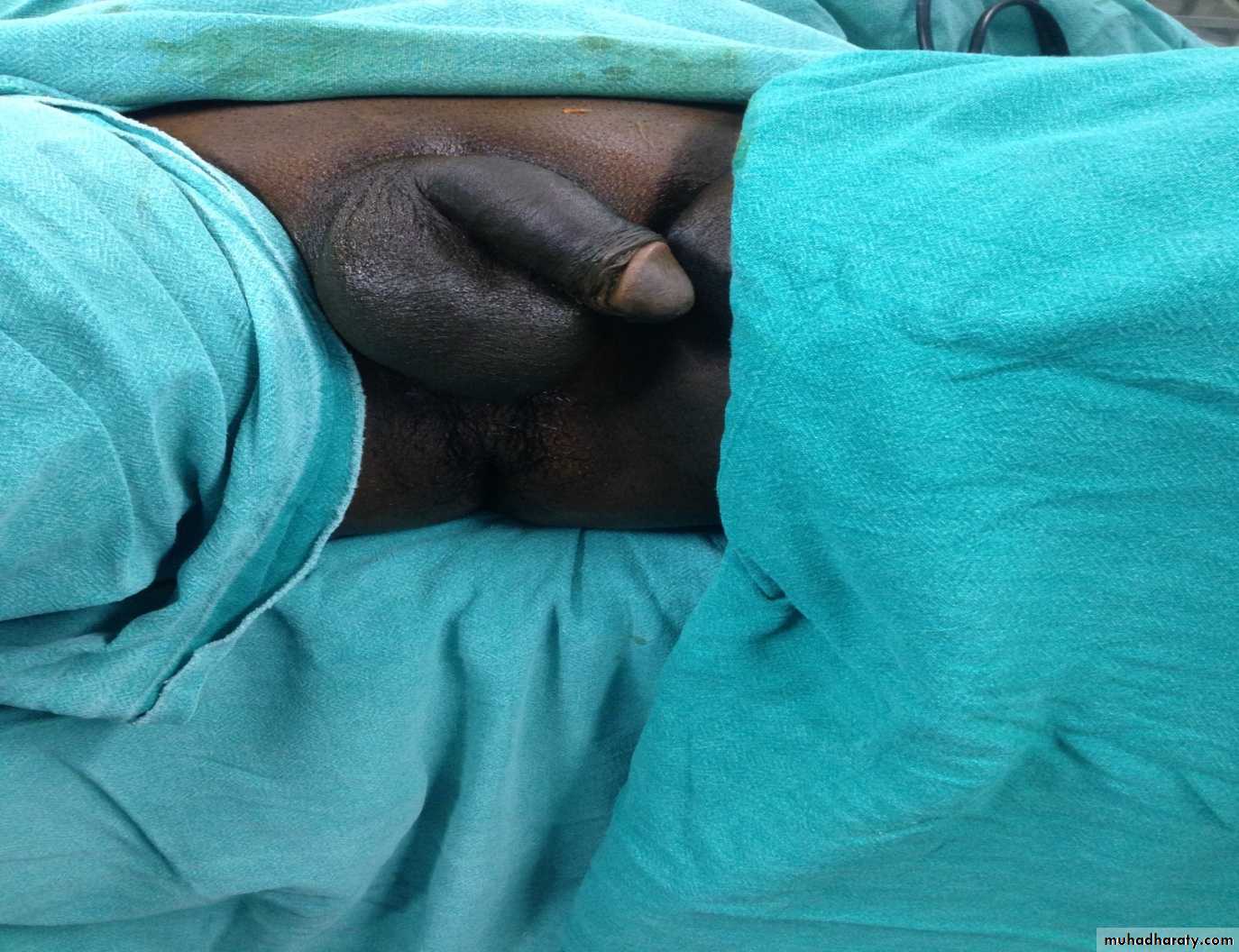 Urology