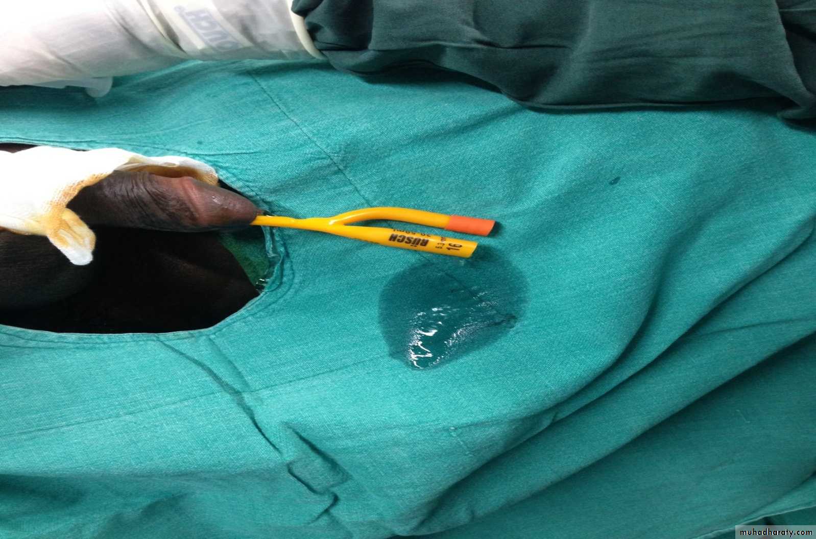 Urology