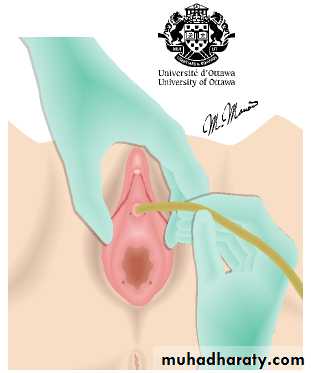 Urology