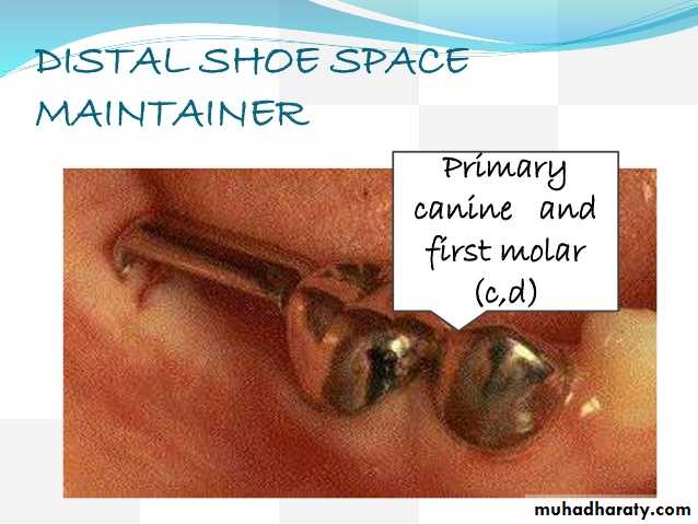 space maintainer