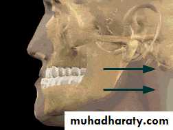 orthognathic surgery