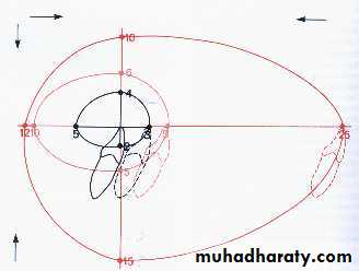 orthognathic surgery