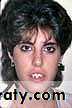 orthognathic surgery