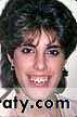 orthognathic surgery