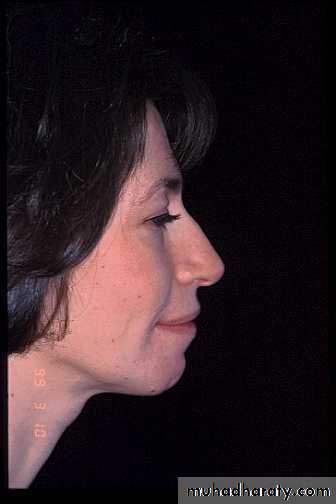 orthognathic surgery