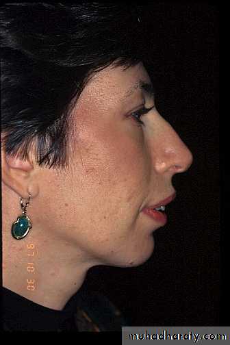 orthognathic surgery