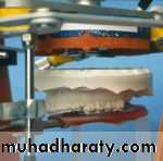 orthognathic surgery