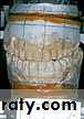 orthognathic surgery