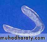orthognathic surgery
