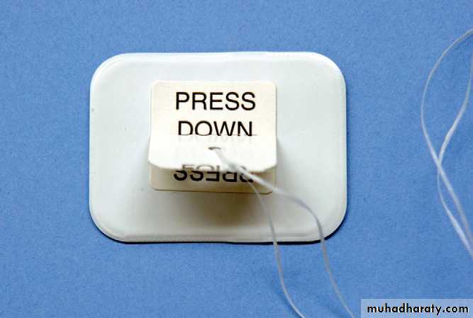 dental care of children with special needs