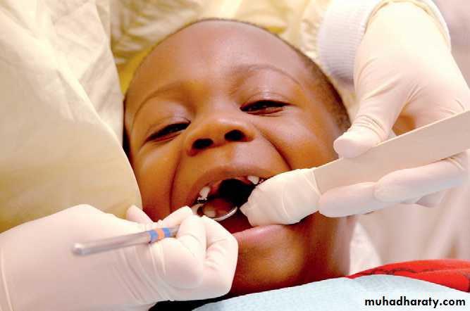 dental care of children with special needs