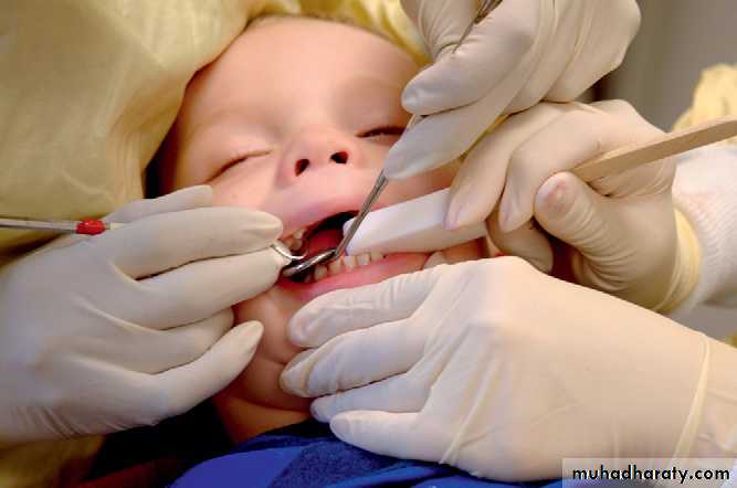 dental care of children with special needs